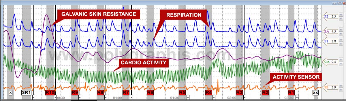 Polygraph Chart Markings